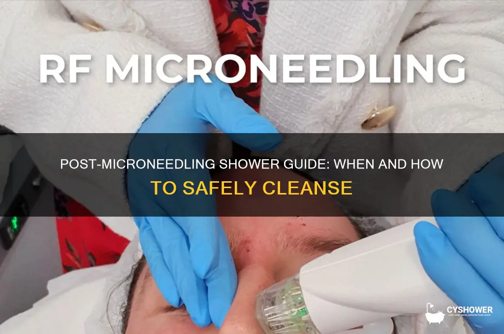 can i take shower after microneedling