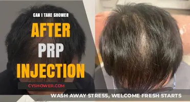 Post-PRP Injection Shower Guidelines: What You Need to Know