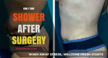 Post-Surgery Shower Guide: When and How to Safely Clean Up