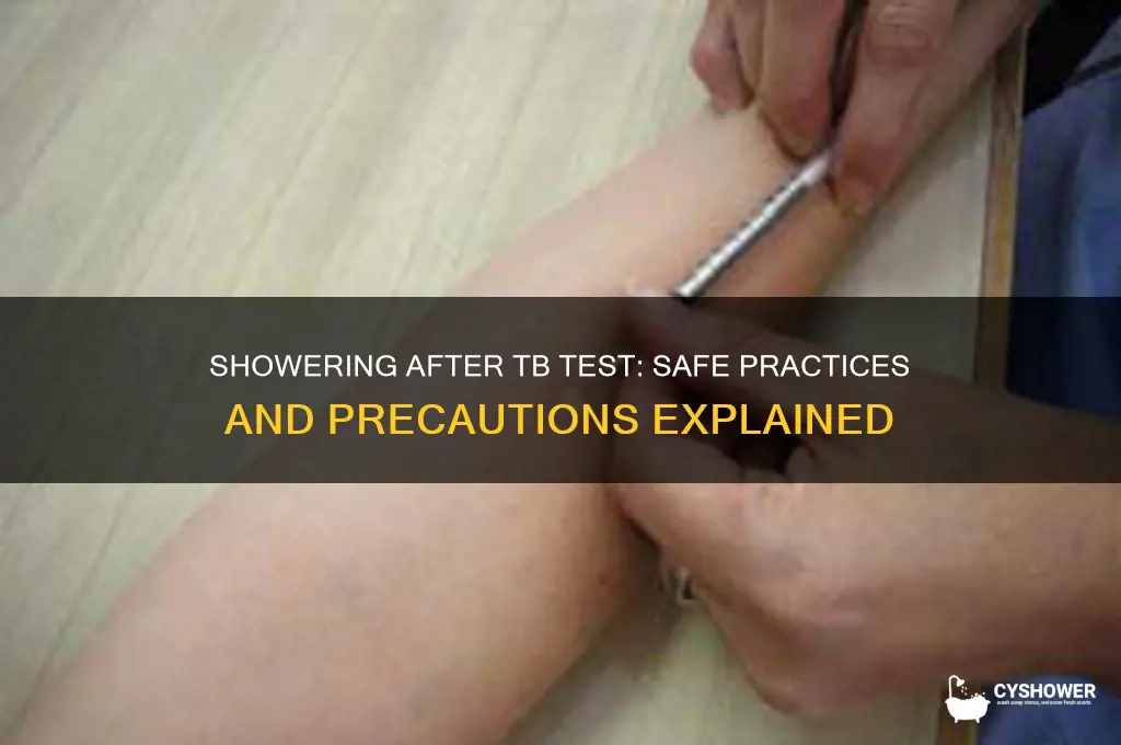 can i take shower after tb test