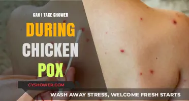 Showering with Chicken Pox: Safe Practices and Precautions to Follow