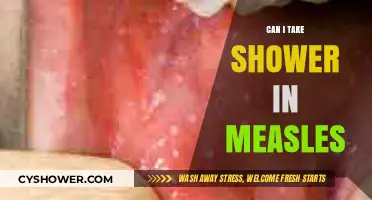 Measles and Showers: Safe Practices for Bathing During Infection