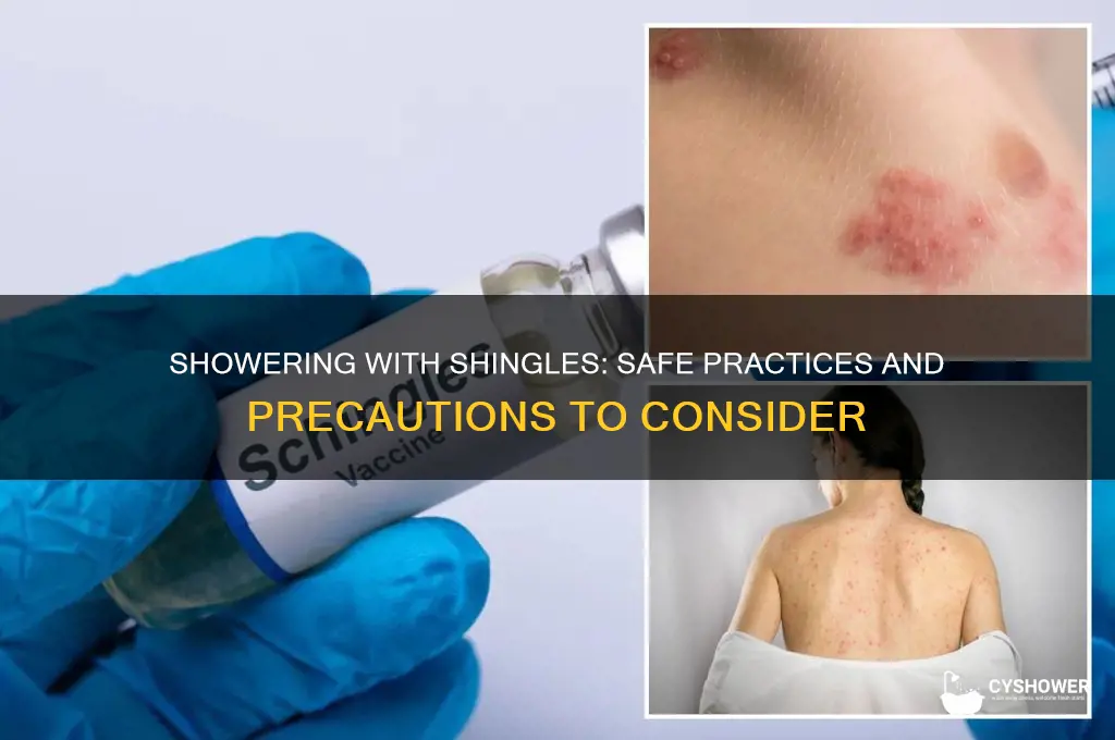 can i tkae shower with shingles