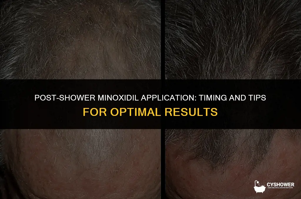 can i use minoxidil after shower