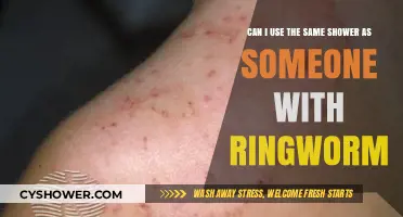 Sharing Showers Safely: What You Need to Know About Ringworm