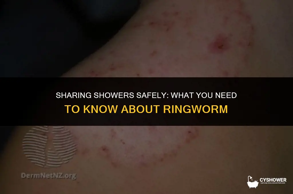 can i use the same shower as someone with ringworm
