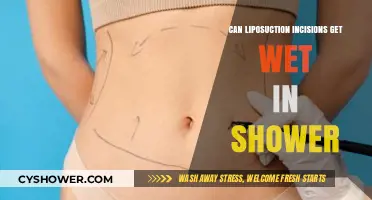 Can Liposuction Incisions Get Wet in the Shower? Post-Op Care Tips