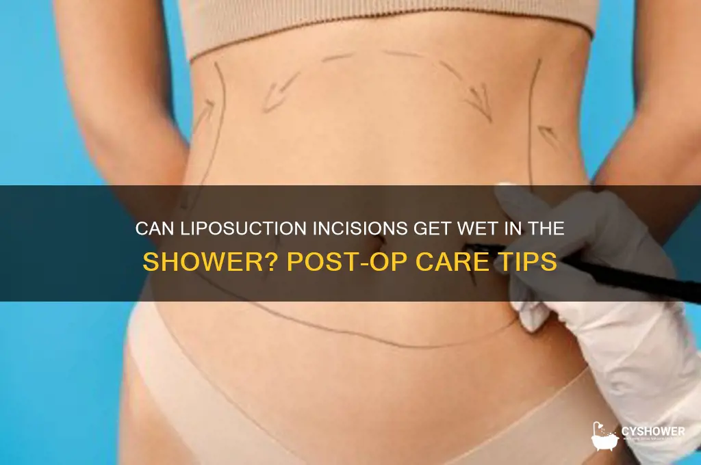 can liposuction incisions get wet in shower