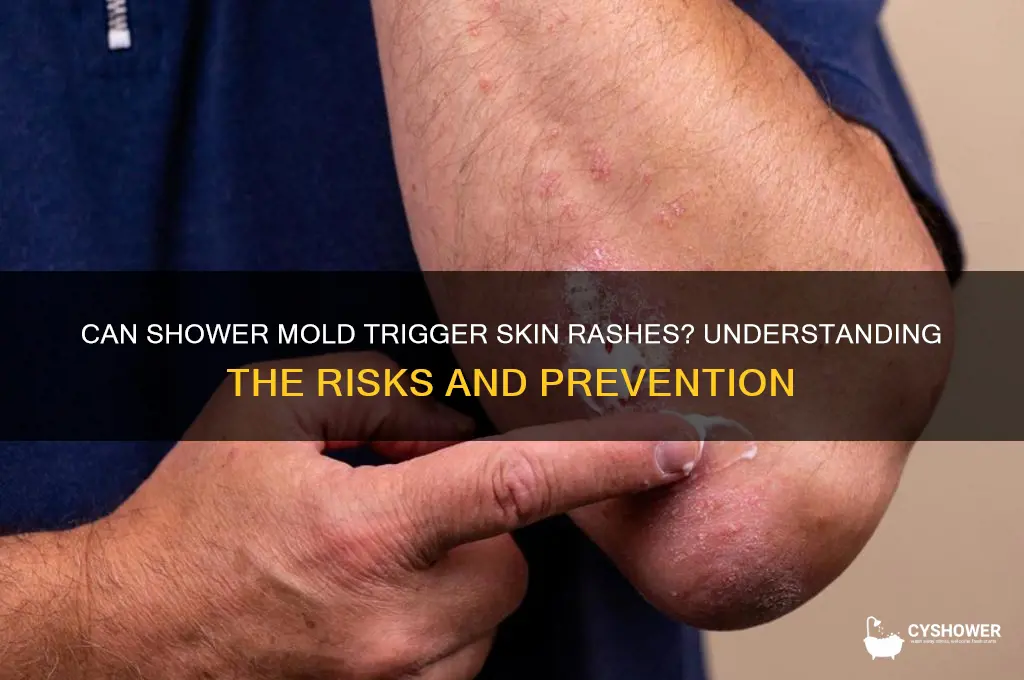 can mold in shower cause rash