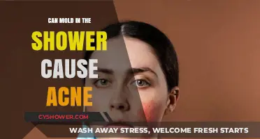 Mold in Your Shower: A Hidden Culprit Behind Acne Breakouts?