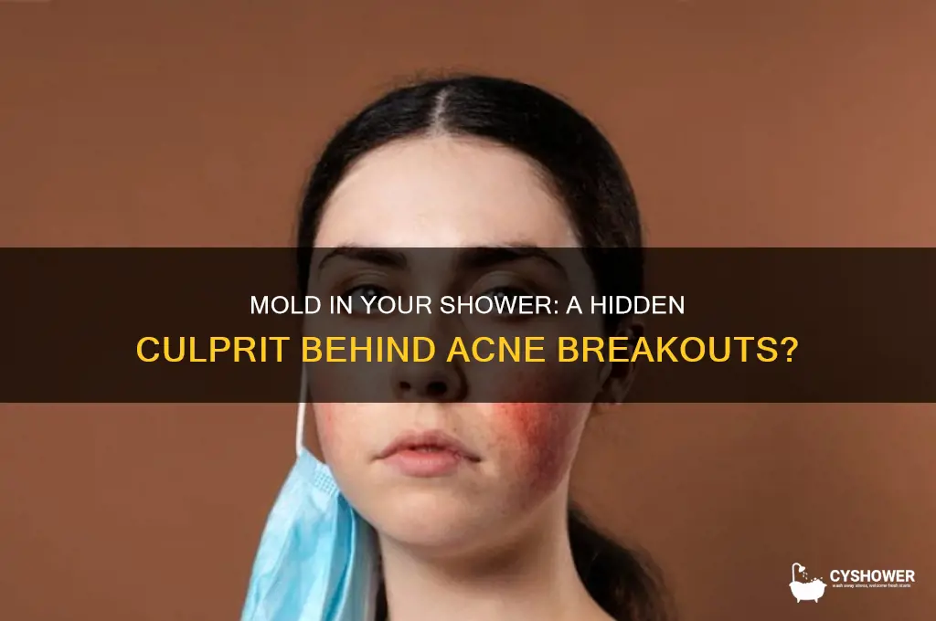 can mold in the shower cause acne