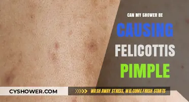 Shower Habits and Skin: Unraveling the Link to Felicotti's Pimple