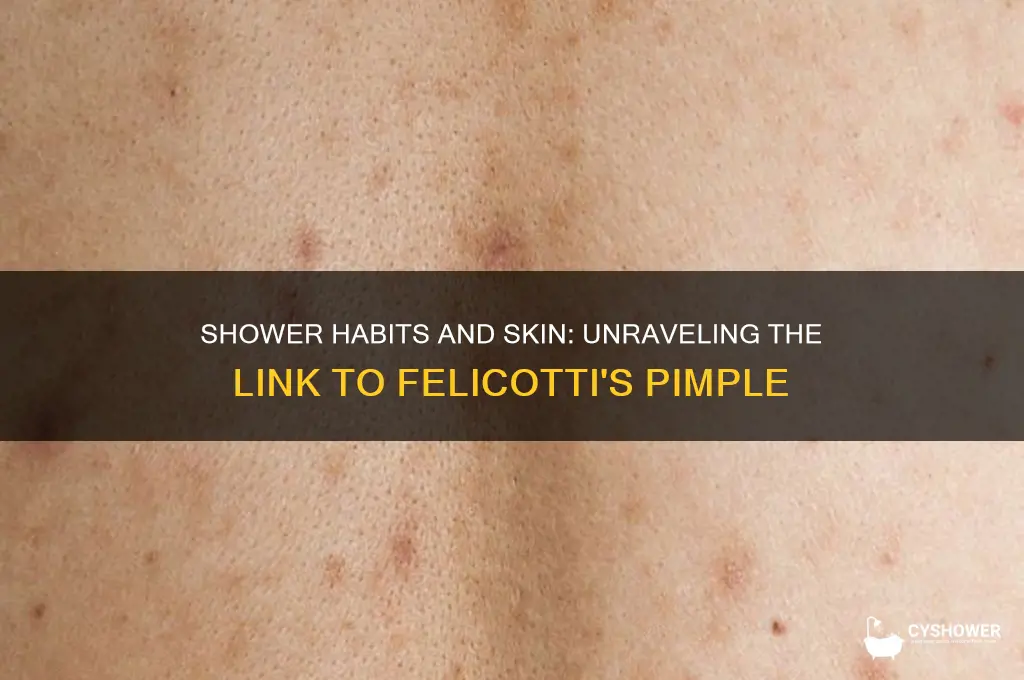 can my shower be causing felicottis pimple