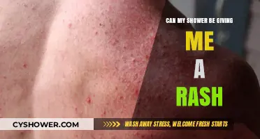 Shower Rashes: Causes, Prevention, and When to Seek Help