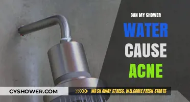 Can Shower Water Trigger Acne? Uncovering the Hidden Skin Connection