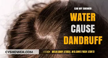 Can Hard Shower Water Trigger Dandruff? Uncover the Surprising Connection