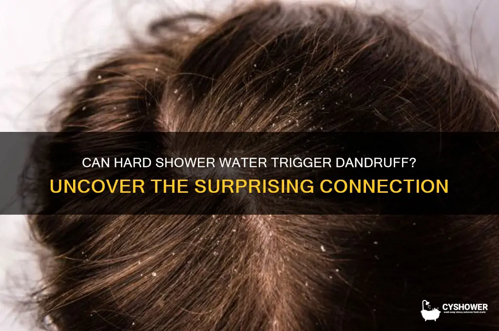 can my shower water cause dandruff