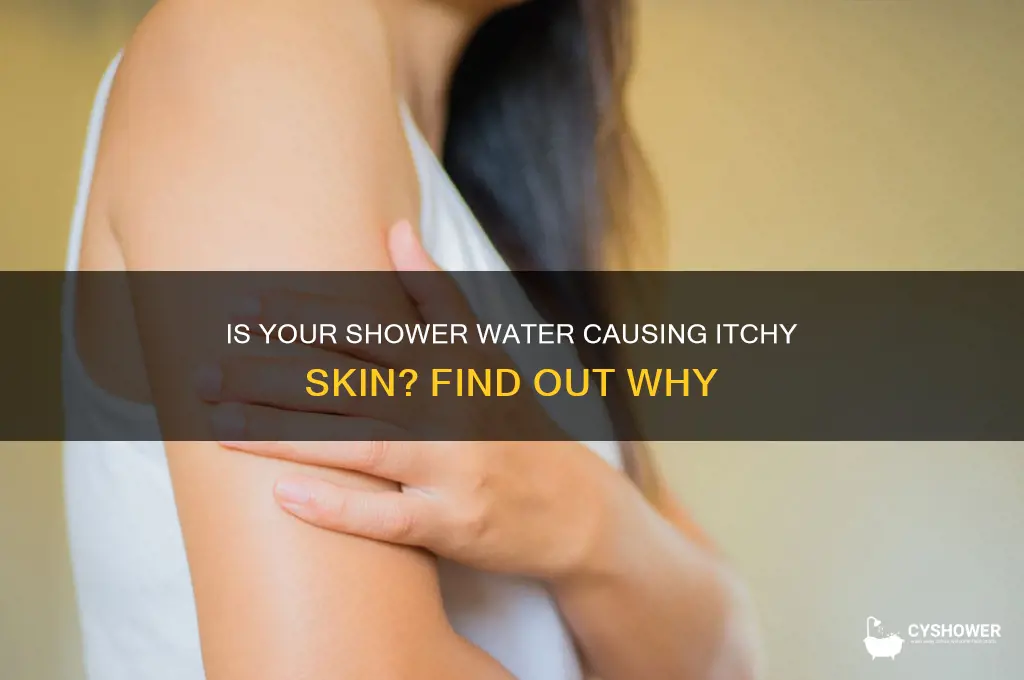 can my shower water make me itchy