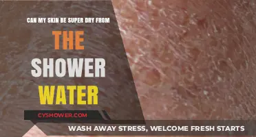 Is Your Shower Water Causing Extremely Dry Skin? Find Out How