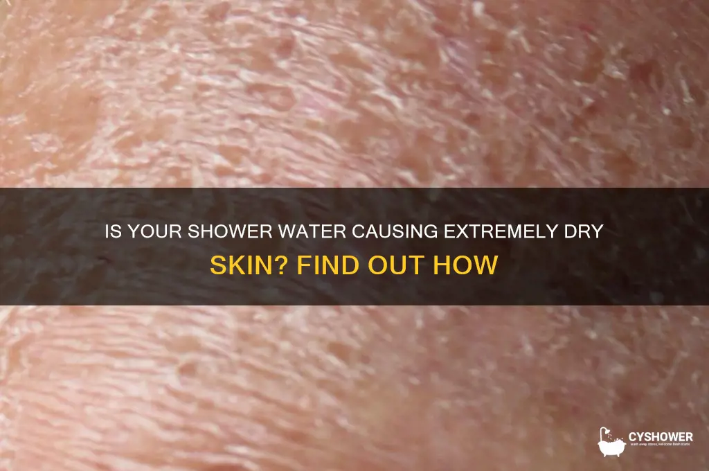 can my skin be super dry from the shower water