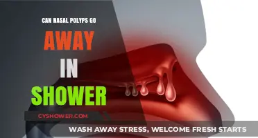 Can Nasal Polyps Shrink or Disappear During Showers? Facts Revealed