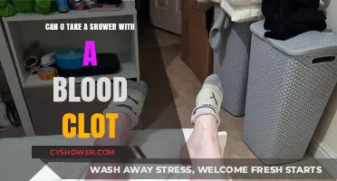 Showering Safely with a Blood Clot: What You Need to Know