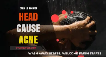 Can Your Old Shower Head Be Triggering Your Acne Breakouts?
