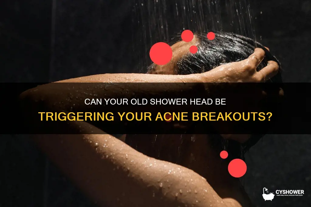 can old shower head cause acne