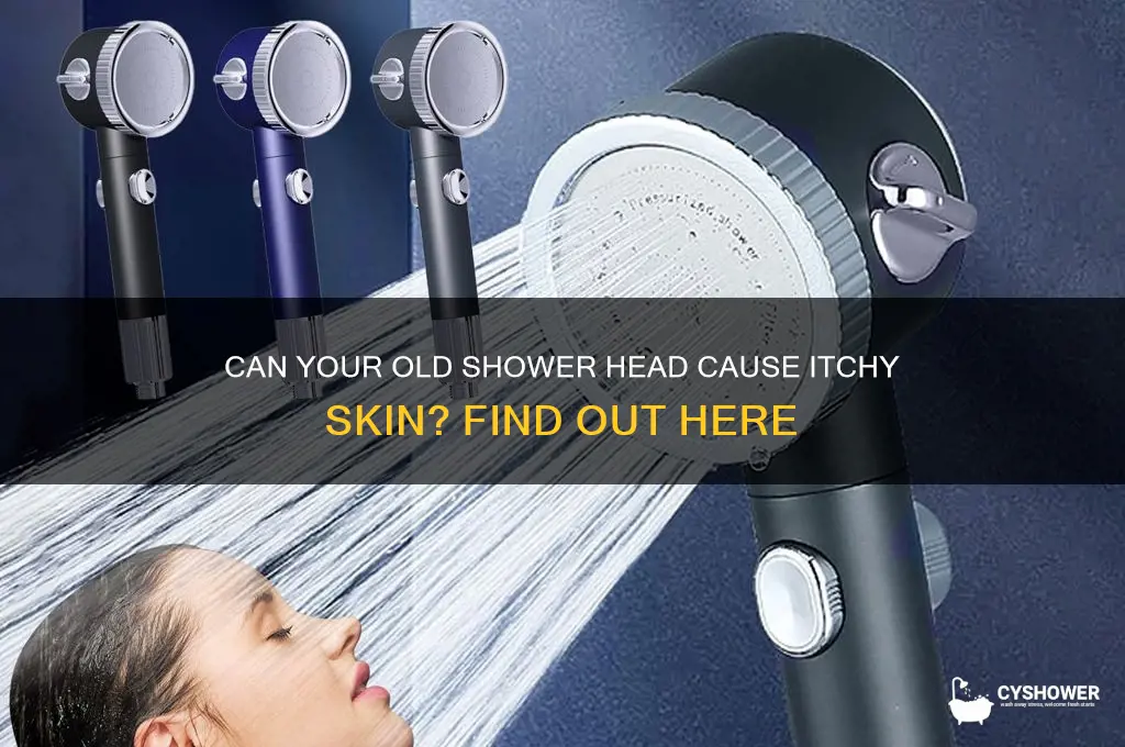 can old shower head make you itchy