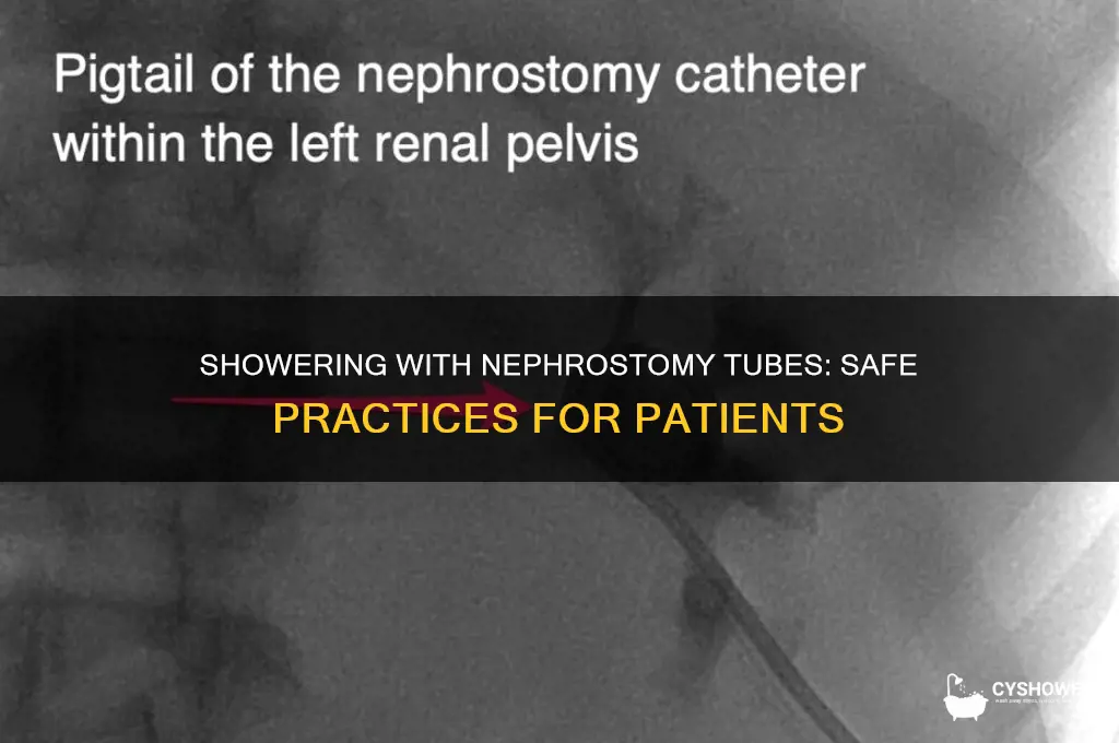 can patients shower with nephrostomy tubes