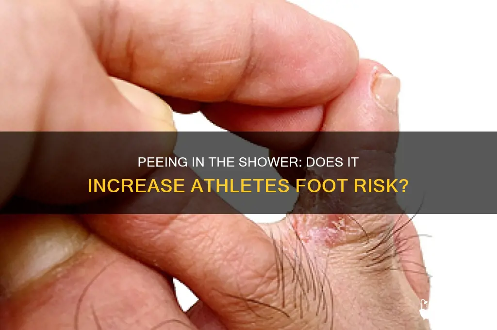 can peeing in the shower cause athletes foot