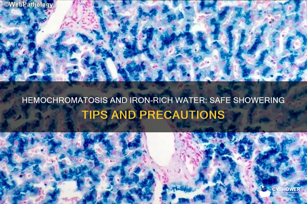 can people with hemochromotosis shower in water that contains iron