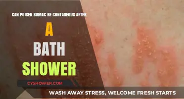 Is Poison Sumac Contagious After Showering? Debunking the Myth