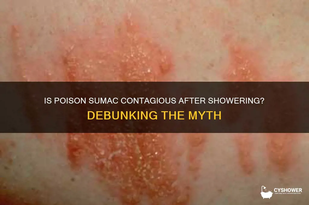 can poisen sumac be contageous after a bath shower