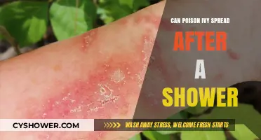 Can Poison Ivy Spread Post-Shower? Debunking Myths and Facts