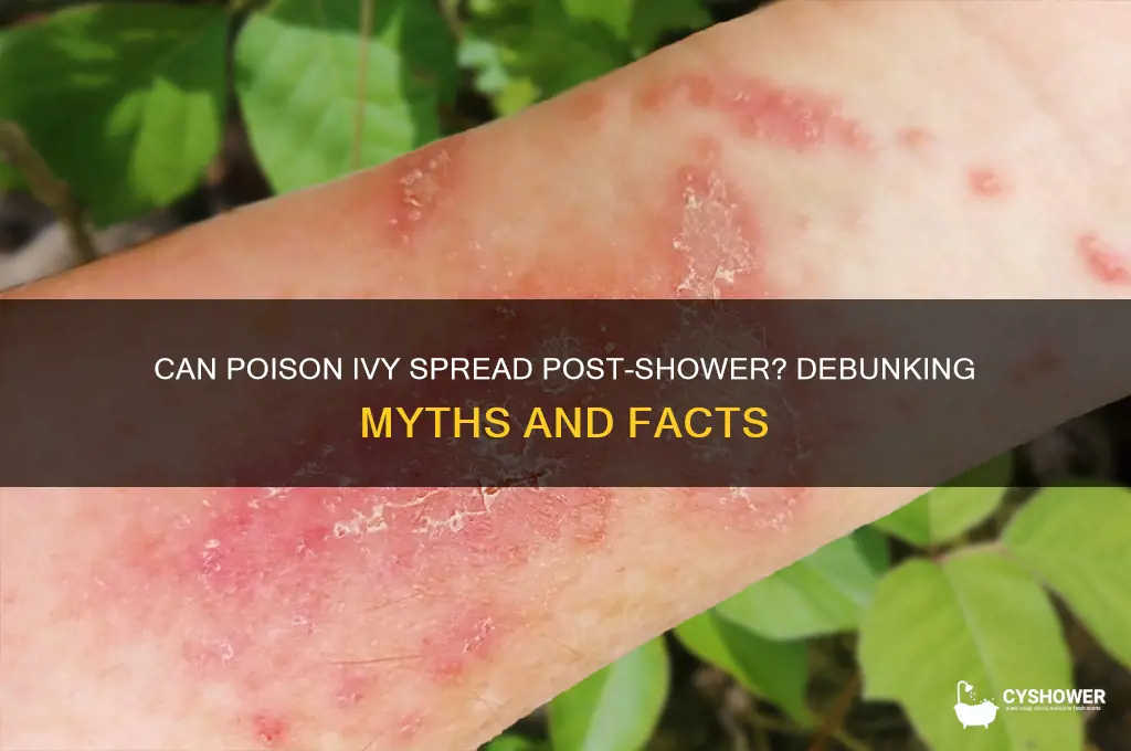 can poison ivy spread after a shower