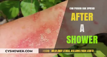 Can Poison Oak Spread Post-Shower? Debunking Myths and Facts