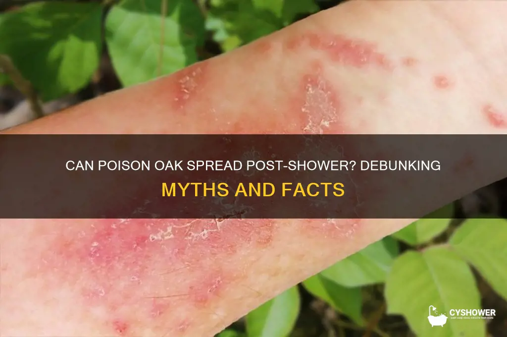 can poison oak spread after a shower