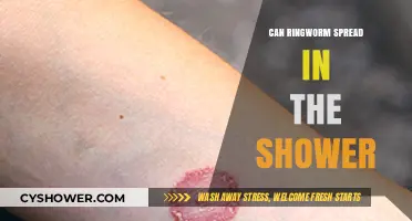 Can Ringworm Spread in the Shower? Facts and Prevention Tips