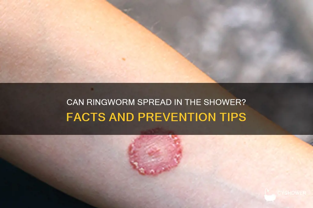 can ringworm spread in the shower