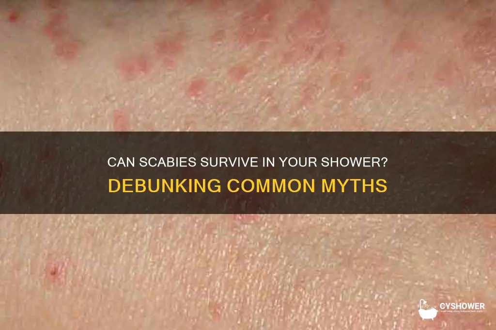 can scabies live in shower