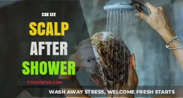 Why Can You See Your Scalp After Showering? Causes & Solutions