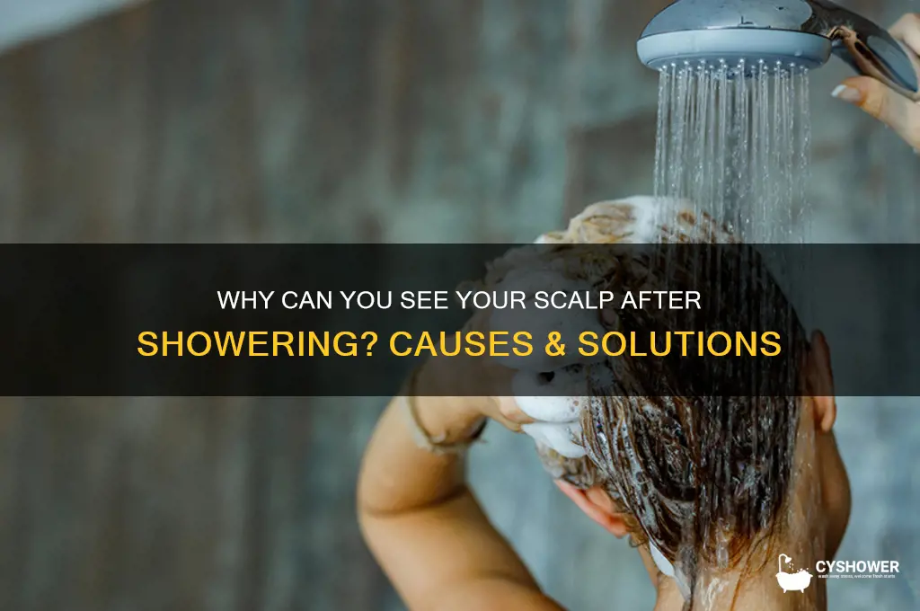 can see scalp after shower
