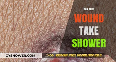 Can You Shower with a Gunshot Wound? Healing and Hygiene Tips