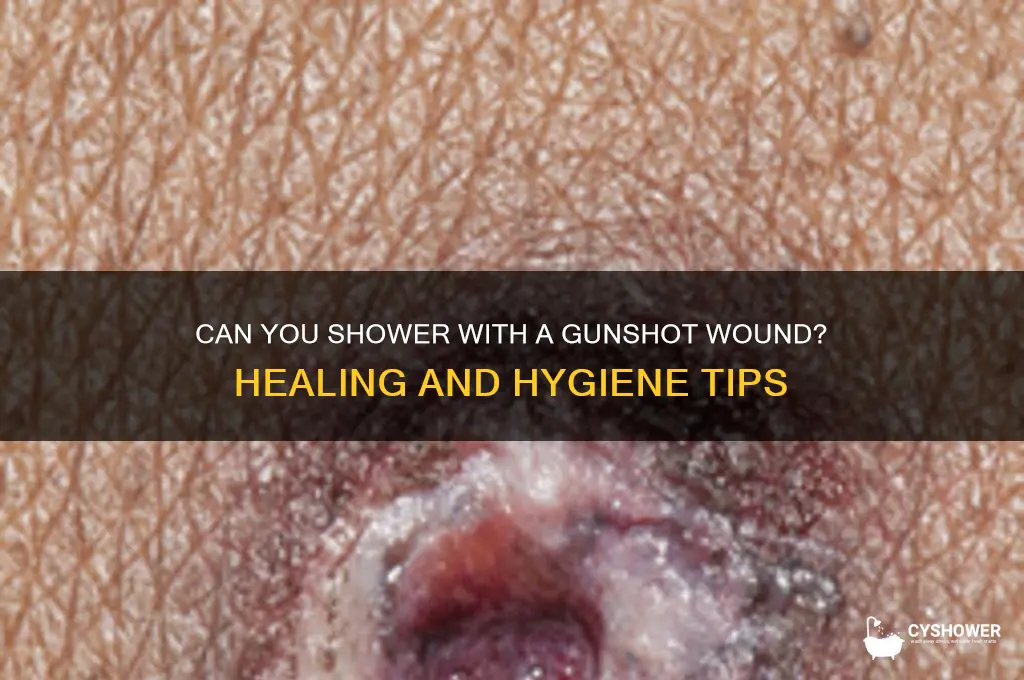 can shot wound take shower