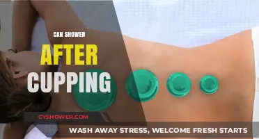 Can You Shower After Cupping? Post-Treatment Care Tips Revealed