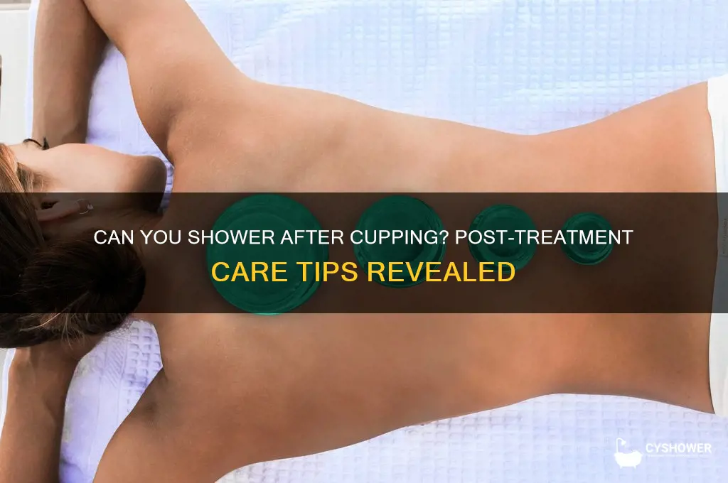 can shower after cupping