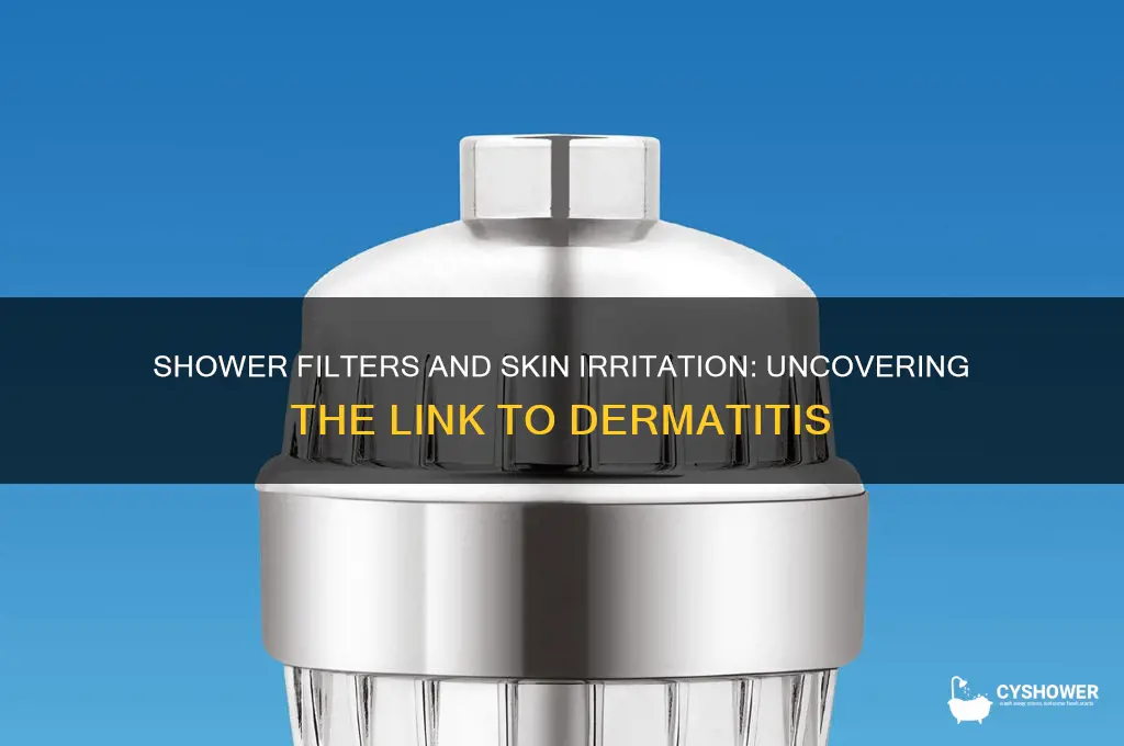 can shower filters cause dermatitis