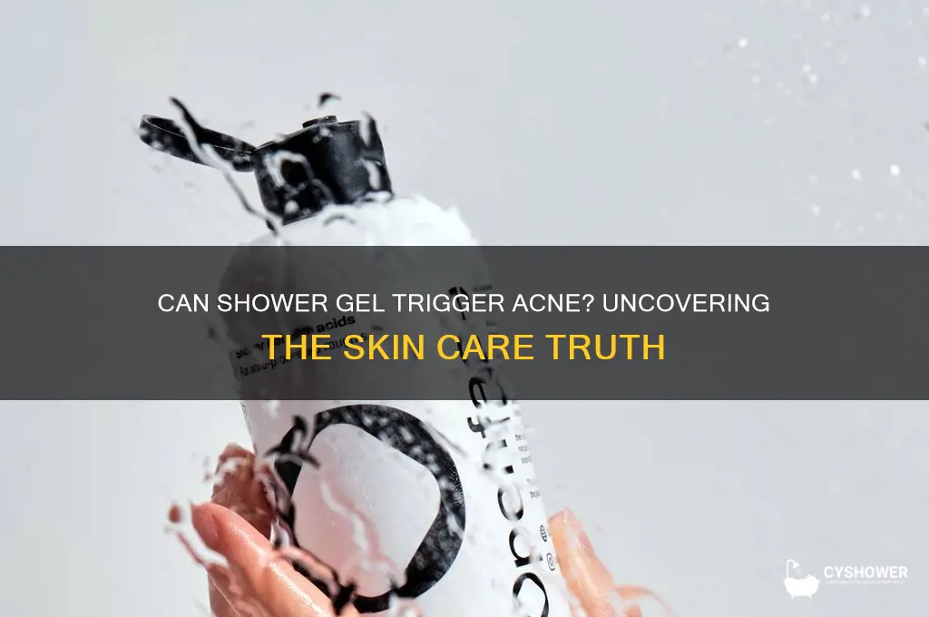 can shower gel cause acne