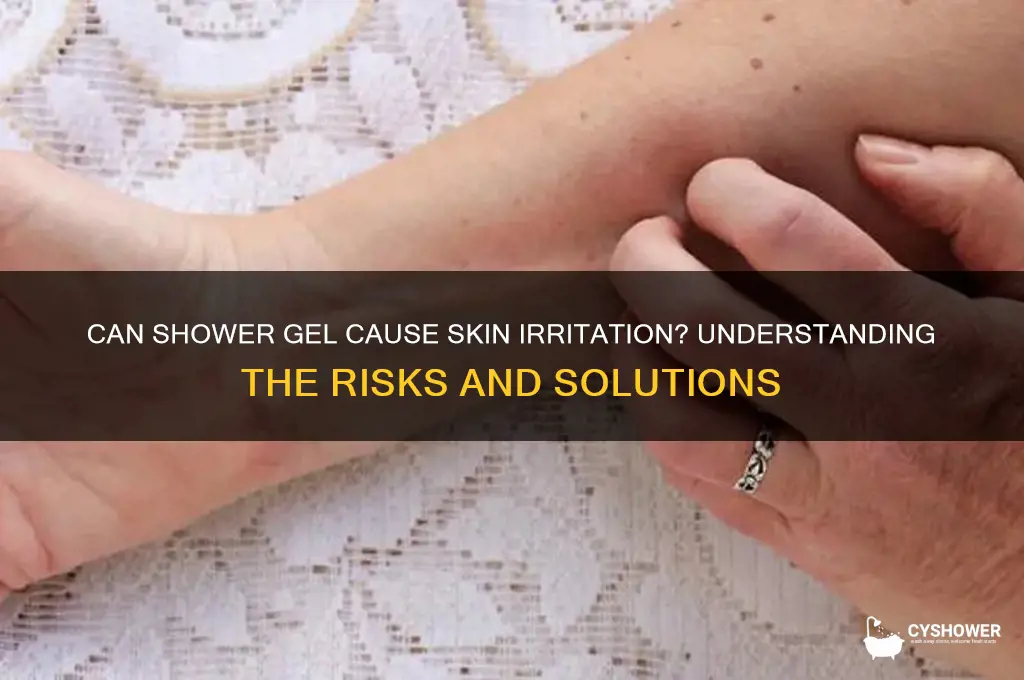 can shower gel cause irritation